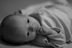 Acupuncture Treatment